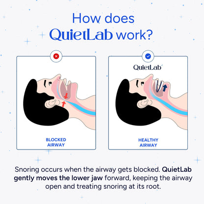 QuietLab Pro Anti-Snoring Mouthpiece - Adjustable Snoring Mouth Guard